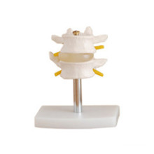 Lumbar Simulation Model with 2PCS/3PCS/4PCS Weichengya